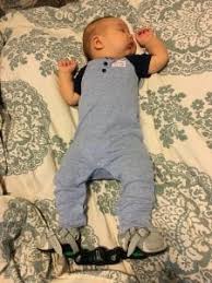 Club′ foot′, furniture. furniturea knoblike foot formed from the end of a cabriole leg as a continuation of its lines: In Honor Of World Clubfoot Day My Journey As A Clubfoot Mama Katy Moms