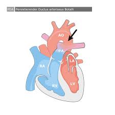 Hz) is the derived unit of frequency in the international system of units (si) and is defined as one cycle per second. Herzkinder Herzfehler Von A Z