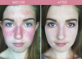 Wally Rodriguez (walesrod0482)