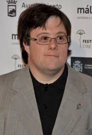 Pablo Pineda is a Spanish actor and won an award for Yo, Tambien. In the movie, he played a university graduate with Down syndrome. He was the first student with Down syndrome