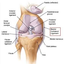 With a moderate grade ii mcl sprain, the knee ligament tears partially. Mcl Sprains Part 1 Anatomy Function Mechanism Of Injury Diagnosis Pogo Physio Gold Coast