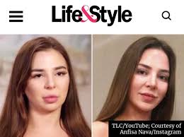What did Anfisa do to her face? Looks way better now. :  r90dayfianceuncensored