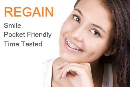 Metal Braces product image