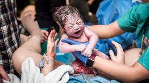Vaginal Birth Vaginal Delivery Basics Childbirth Stages More