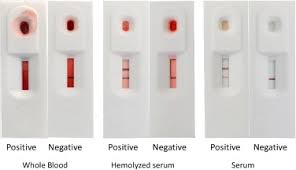 Rapid antigen tests are not confirmatory and can never replace the pcr, which is widely accepted the effectiveness of the rapid test depends on the stage of the disease, but the positive thing is that. Evaluation Of The Diagnostic Accuracy Of An Affordable Rapid Diagnostic Test For African Swine Fever Antigen Detection In Lao People S Democratic Republic Sciencedirect