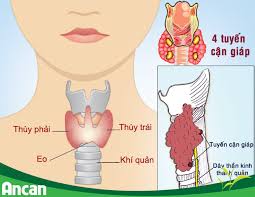 Lời khuyên giúp người ung thư tuyến tụy có thời gian và chất lượng sống cao hơn. Dáº¥u Hiá»‡u Nháº­n Biáº¿t Ung ThÆ° Tuyáº¿n Giap