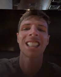 Start to finish! 25 teeth pulled Wednesday, 6/11 at 8:55 AM. Permanents  bolted in place yesterday, Thursday, 6/12. Back home in Nashville  recovering. Still fairly swollen and look like a chipmunk but