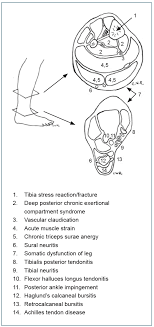 We did not find results for: Achilles Tendon Disorders