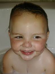 Twin Births in the 1900s: Survival Rates and Challenges