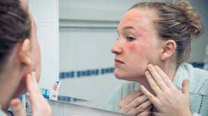 The rash could be red, itchy and at times just small bumps that are not itchy. Common Skin Rashes Everyday Health