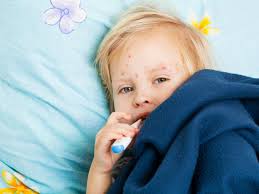 Non è un caso, infatti, che la malattia possa. Scarlattina Nei Bambini Cos E Cause Sintomi E Cure Bimbisaniebelli It