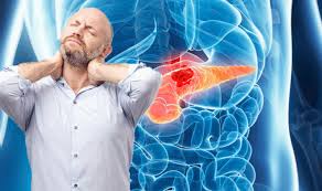 Though some of the signs and symptoms of this cancer can resemble other health conditions like diabetes, cirrhosis, or liver disease, it's important to have things checked out if you notice any abnormalities. Pancreatic Cancer Symptoms Include Stomach Or Back Pain Express Co Uk