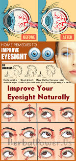Improve Your Eyesight Naturally Eye Exercises Eye Sight Improvement Eye Health