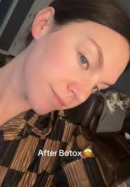 Botox always makes me happy! ❤️ #botox #thirties #fyp