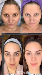 I never believed in eye cream… Until I discovered the time-defying  miniprotein™ technology in Take Back Time, our new eye treatment from  Trinny London Lab. Did you know that the skin's genetic