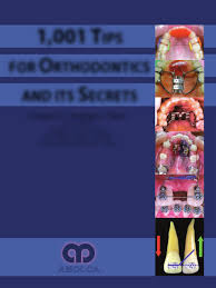 Class ii elastics were continued for anchorage. 1001 Tips In Orthodontics And Its Secrets Pdf Txt