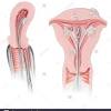 Biologisch betrachtet ist es nach einer fehlgeburt schon mit deinem nächsten eisprung wieder möglich, schwanger zu werden. Https Encrypted Tbn0 Gstatic Com Images Q Tbn And9gcsh6lqj9rkmtqlwsray9opfrmio0qiggnypumsxr28rcn0rszxc Usqp Cau