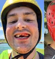 Telco super-geek Liam Farr makes bloody case for a full-face helmet