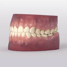 Teeth And Gums Lp Triangulated Without Roots Gum Teeth Creature Design