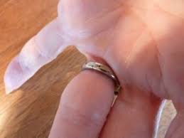 Get the credit you deserve. Finger Mate Hinging Shank For Rings For Enlarged Knuckles Calla Gold Jewelry