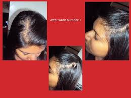 Whether you are concerned about future hair loss or you're experiencing thinning hair right now, nioxin might be the answer you're looking for. Nioxin Nioxin Hair System Kit 2 Noticeably Thinning Hair Review Beauty Bulletin Treatments Masks