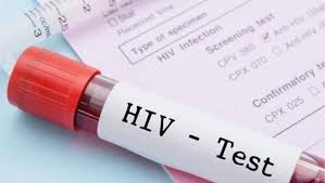 Kini Tes Hiv Aids Bisa Dicek Sendiri Dengan Mudah Di Rumah