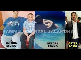 Pin On Bariatric Surgery India Punjab
