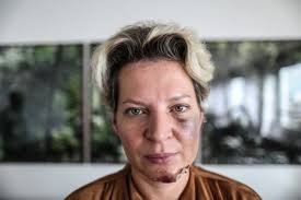 Joice cristina hasselmann is a brazilian politician, journalist, writer, activist and political commentator. O Que Houve Com Joice
