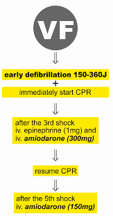 Image result for Ventricular Fibrillation