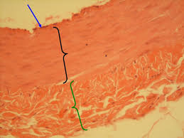 Major artery which takes blood to the body.; Histology Of Blood Vessels