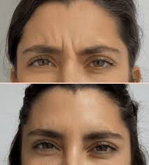 Tampa bay be like #breakaway