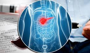 Symptoms can include pain, swelling, redness, and warmth in the affected leg. Pancreatic Cancer Test Could Detect Early Signs Of Deadly Disease Express Co Uk
