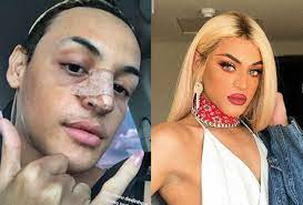 The two pop stars talk lgbtq culture, dream diva collabs, and diplo's lips. Pin Em Pabllo Vittar