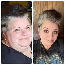 Upcoming surgery causing stress and anxiety