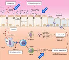 This review will discuss how cd4 t cell responses. Intestinal Microbiota And Probiotics In Celiac Disease Clinical Microbiology Reviews