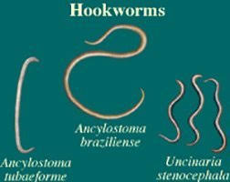 Image result for Hookworm