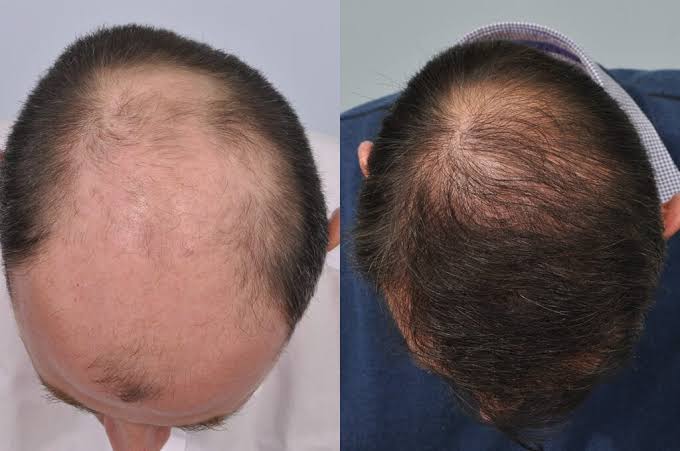 Before