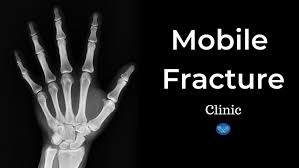 Mobile Fracture Clinic Gold Coast In 2020 Clinic It Cast Hand Therapy