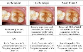 Most commonly the first permanent (adult) molars and incisors (front teeth) are affected. A Questionnaire Study On Perception And Clinical Management Of Molar Incisor Hypomineralisation Mih By Irish Dentists Springerlink