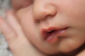 Bagaimana cara mendiagnosis sianosis pada bayi? Mengenal Sianosis Kondisi Bibir Hitam Pada Bayi Orami