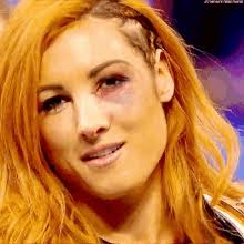 We would like to show you a description here but the site won't allow us. Black Eye Gifs Tenor