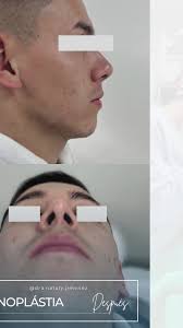 Nataly Jiménez Cirujana