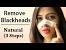 Nose Hair Removal Strips
