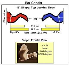 It is about 4 cm. The Human Ear Canal Ii Wayne Staab Phd Hearinghealthmatters Org Waynesworld