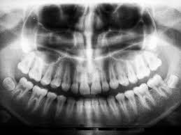 Looking for free dental exam and x ray? 350 Dental Pictures Hd Download Free Images On Unsplash