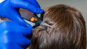 Hair testing analyzes drugs within the hair shaft, rather than body fluids like urine or saliva, to determine whether drugs of how much hair is needed for a hair drug test? Effects Of Hair Treatments On Drug Test Results Quest Diagnostics