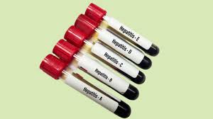 Blood collection tubes labeled for hepatitis A through E viral testing