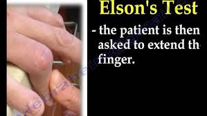 Image result for Elson Extensor Tendon Test