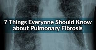 As is the case for many cancers, it's likely you won't notice symptoms until the lung cancer is in an advanced stage. 7 Things Everyone Should Know About Pulmonary Fibrosis American Lung Association
