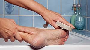 Instead of water, you can also mix in equal portions of white vinegar. How To Get Rid Of Dry Skin On Your Feet Howstuffworks